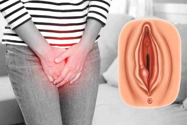 Xót vùng kín: phân biệt da kích ứng với tiểu buốt và viêm nhiễm