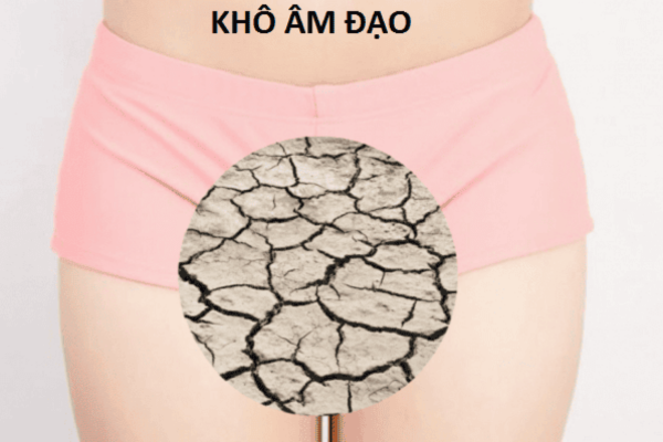 Khô âm đạo: phân biệt chất bôi trơn, dưỡng ẩm và điều trị nội tiết