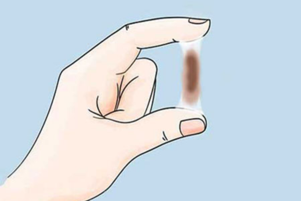 Khí hư màu nâu: máu cũ, thời điểm xuất hiện và dấu hiệu cần khám