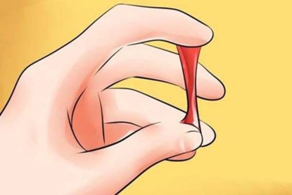 Khí hư có máu: đánh giá vệt máu theo chu kỳ, quan hệ và tuổi