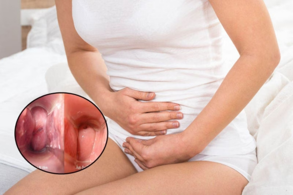 Viêm phụ khoa: hiểu phạm vi bệnh và cách nhận biết biến chứng