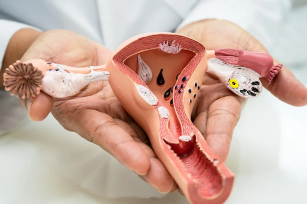 Khám phụ khoa ở Đồng Tháp: riêng tư, hồ sơ và chuẩn bị trao đổi