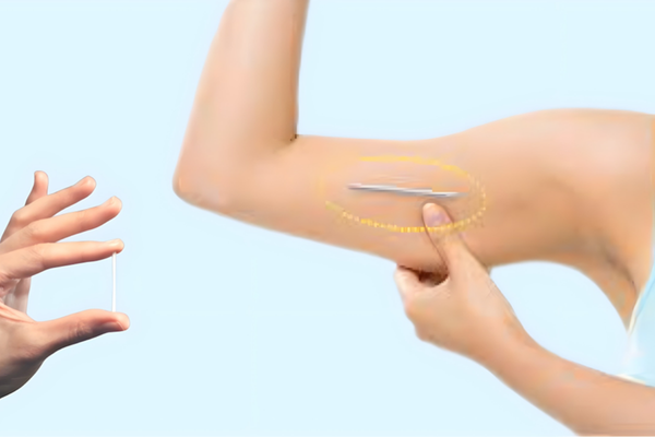 Nên cấy que tránh thai ở đâu tại Đồng Tháp? Các tiêu chí cần hỏi