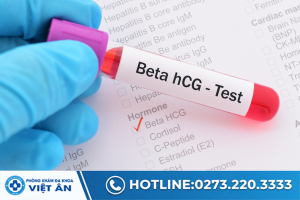 xet-nghiem-hcg